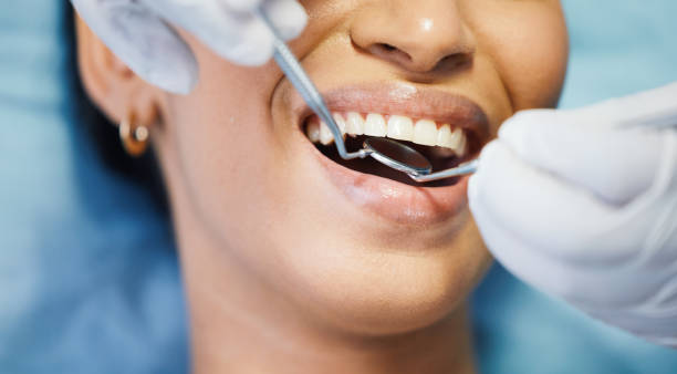 Best Urgent Tooth Repair  in Milton, DE