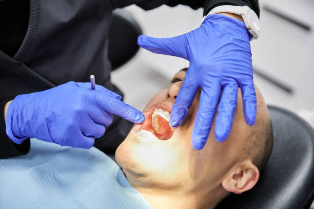 Best Cracked Tooth Emergency Dentist  in Milton, DE